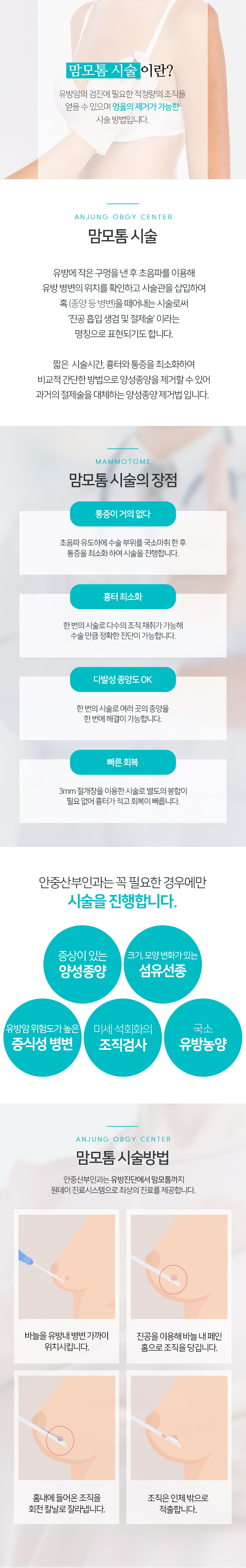 맘모톰 시술이란? 유방암의 검진에 필요한 적정량의 조직을 얻을 수 있으며, 멍울의 제거가 가능한 수술방법입니다.

			유방에 작은 구멍을 낸 후 초음파를 이용해 유방 병변의 위치를 확인하고
				시술관을 삽입하여 혹 (종양 등 병변)을 떼어내는 시술로써
				'진공 흡입 생검 및 절제술'이라는 명칭으로 표현하기도 합니다.

				짧은 시술시간, 흉터와 통증을 최소화하여 간단하게 양성종양을
				제거할 수 있어 과거의 절제술을 대체하는 양성종양 제거법입니다.

				맘모톰 시술의 장점

				01. 통증이 거의 없습니다.
				초음파 유도하에 수술부위를 국소마취 한 후 통증을
				최소화하여 수술을 진행합니다.

				02. 충분한 조직 채취
				한번의 시술로 다수의 조직 채취가 가능해
				수술만큼 정확한 진단이 가능합니다.

				03. 다발성 종양도 OK!
				한번의 시술로 여러곳의 종양을 한번에 해결 가능합니다.

				04. 흉터 최소화, 빠른 회복
				3mm절개창을 이용한 시술로
				별도의 봉합이 필요 없어 흉터가 거의 없고 회복이 빠릅니다.

				안중산부인과는 꼭 필요한 경우에만 시술을 진행합니다.

				- 증상이 있는 (양성종양)
				- 크기, 모양변화가 있는 (섬유선종)
				- 유방암 위험도가 높은 (증식성 병변)
				- 미세석회화의 (조직검사)
				- 국소 (유방농양)

				맘모톰 시술 방법
					안중산부인과에서는 유방진단에서 맘모톰까지
					원데이 진료시스템으로 최상의 진료를 제공합니다.

					1. 바늘을 유방내 병변 가까이 위치시킵니다.
					2. 진공을 이용하여 바늘내 페인 홈으로 조직을 당깁니다.
					3. 홈내에 들어온 조직을 회전 칼날로 잘라냅니다.
					4. 조직을 인체 밖으로 적출합니다.

			